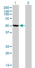 CAMK2D Antibody in Western Blot (WB)