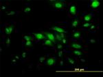 CAPG Antibody in Immunocytochemistry (ICC/IF)