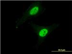 CAPN3 Antibody in Immunocytochemistry (ICC/IF)