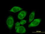 CARS Antibody in Immunocytochemistry (ICC/IF)