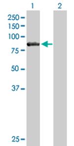 CARS Antibody in Western Blot (WB)