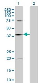 CASP1 Antibody in Western Blot (WB)