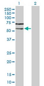 CASP2 Antibody in Western Blot (WB)