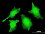 CASP2 Antibody in Immunocytochemistry (ICC/IF)