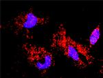 CASP6 Antibody in Proximity Ligation Assay (PLA) (PLA)