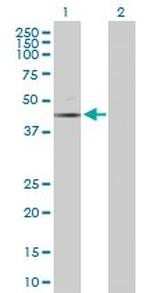 CASP6 Antibody in Western Blot (WB)