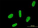 RUNX2 Antibody in Immunocytochemistry (ICC/IF)