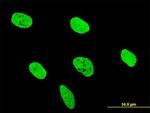 RUNX2 Antibody in Immunocytochemistry (ICC/IF)