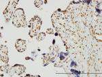 RUNX2 Antibody in Immunohistochemistry (Paraffin) (IHC (P))