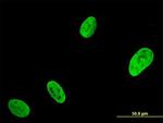 RUNX2 Antibody in Immunocytochemistry (ICC/IF)