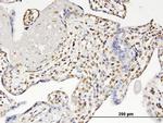 RUNX2 Antibody in Immunohistochemistry (Paraffin) (IHC (P))