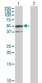 SERPINA6 Antibody in Western Blot (WB)