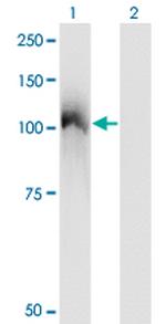 CBL Antibody in Western Blot (WB)