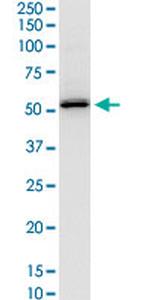 SERPINH1 Antibody in Western Blot (WB)