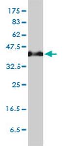 SERPINH1 Antibody in Western Blot (WB)