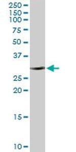 CBR1 Antibody in Western Blot (WB)