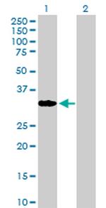 CBR1 Antibody in Western Blot (WB)