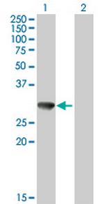 CBR3 Antibody in Western Blot (WB)