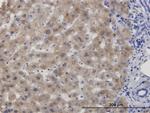 CBS Antibody in Immunohistochemistry (Paraffin) (IHC (P))