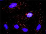 CCNE1 Antibody in Proximity Ligation Assay (PLA) (PLA)