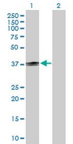 CD1B Antibody in Western Blot (WB)