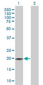 CD3D Antibody in Western Blot (WB)