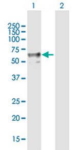 ENTPD2 Antibody in Western Blot (WB)