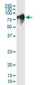 CD44 Antibody in Western Blot (WB)