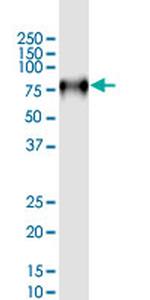 CD44 Antibody in Western Blot (WB)