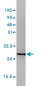 CD58 Antibody in Western Blot (WB)