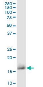 CD59 Antibody in Western Blot (WB)