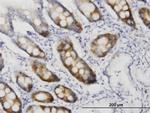 CDC2 Antibody in Immunohistochemistry (Paraffin) (IHC (P))