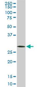 CDC2 Antibody in Western Blot (WB)