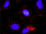 CDC6 Antibody in Proximity Ligation Assay (PLA) (PLA)