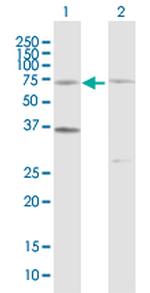 CDC6 Antibody in Western Blot (WB)