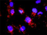 CDC25A Antibody in Proximity Ligation Assay (PLA) (PLA)