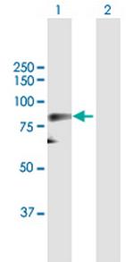 CDC25B Antibody in Western Blot (WB)