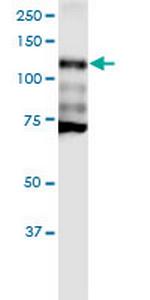 CDH1 Antibody in Western Blot (WB)