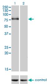 CDH6 Antibody in Western Blot (WB)