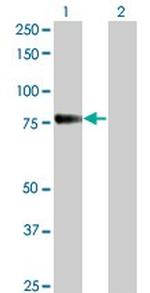 CDH6 Antibody in Western Blot (WB)