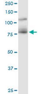 CDH11 Antibody in Western Blot (WB)