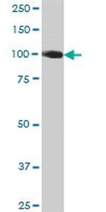 CDH13 Antibody in Western Blot (WB)