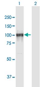 CDH13 Antibody in Western Blot (WB)