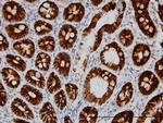 CDH17 Antibody in Immunohistochemistry (Paraffin) (IHC (P))