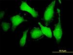 CDK5 Antibody in Immunocytochemistry (ICC/IF)