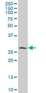 CDK5 Antibody in Western Blot (WB)