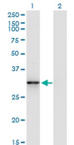 CDK5 Antibody in Western Blot (WB)