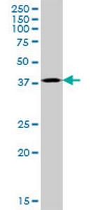 CDK6 Antibody in Western Blot (WB)