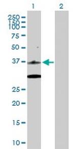 CDK6 Antibody in Western Blot (WB)