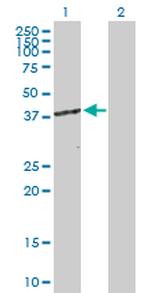 CDK7 Antibody in Western Blot (WB)